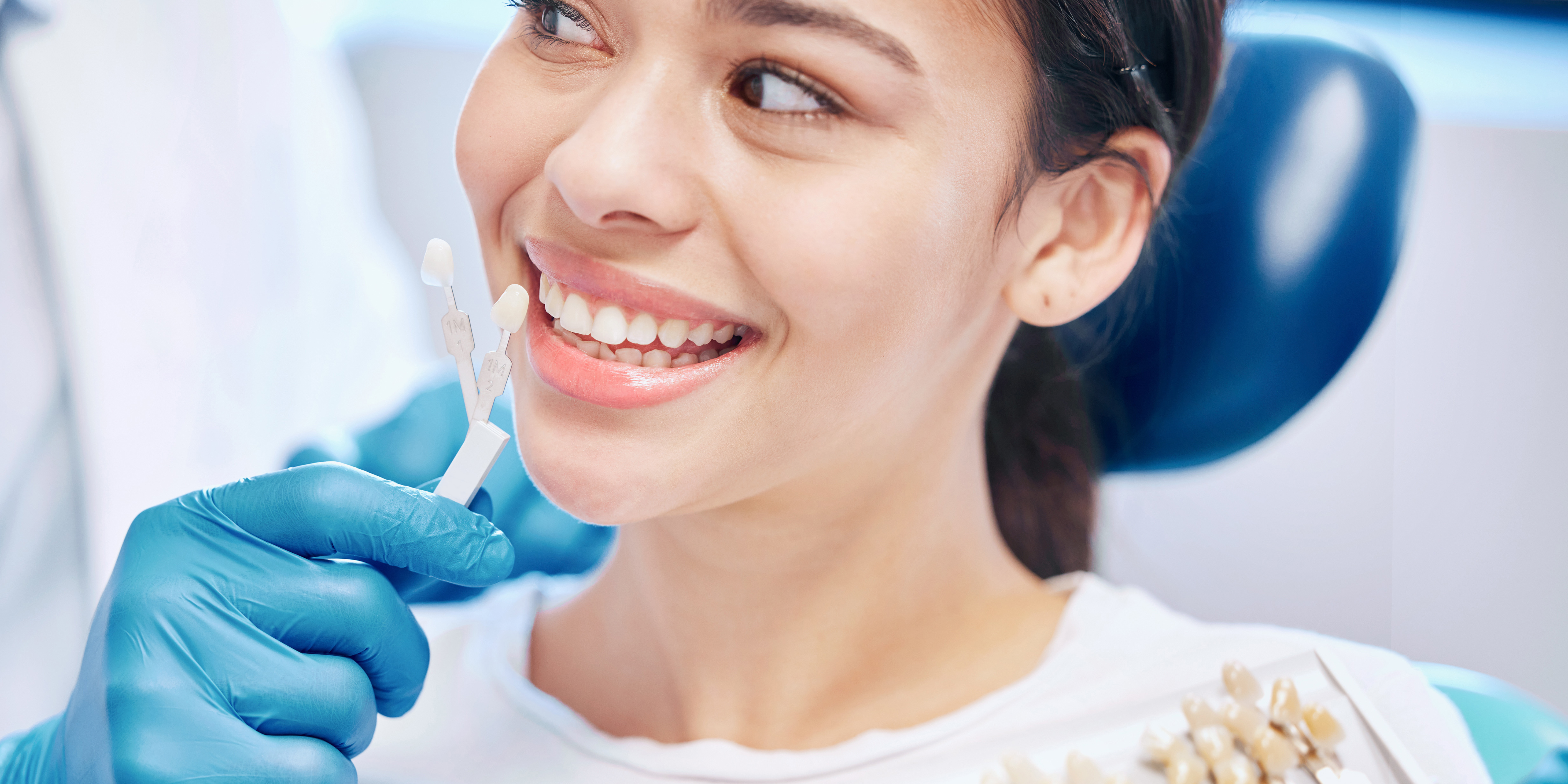 Bọc Răng Sứ Thẩm Mỹ – Giải Pháp Hoàn Hảo Cho Nụ Cười Rạng Rỡ